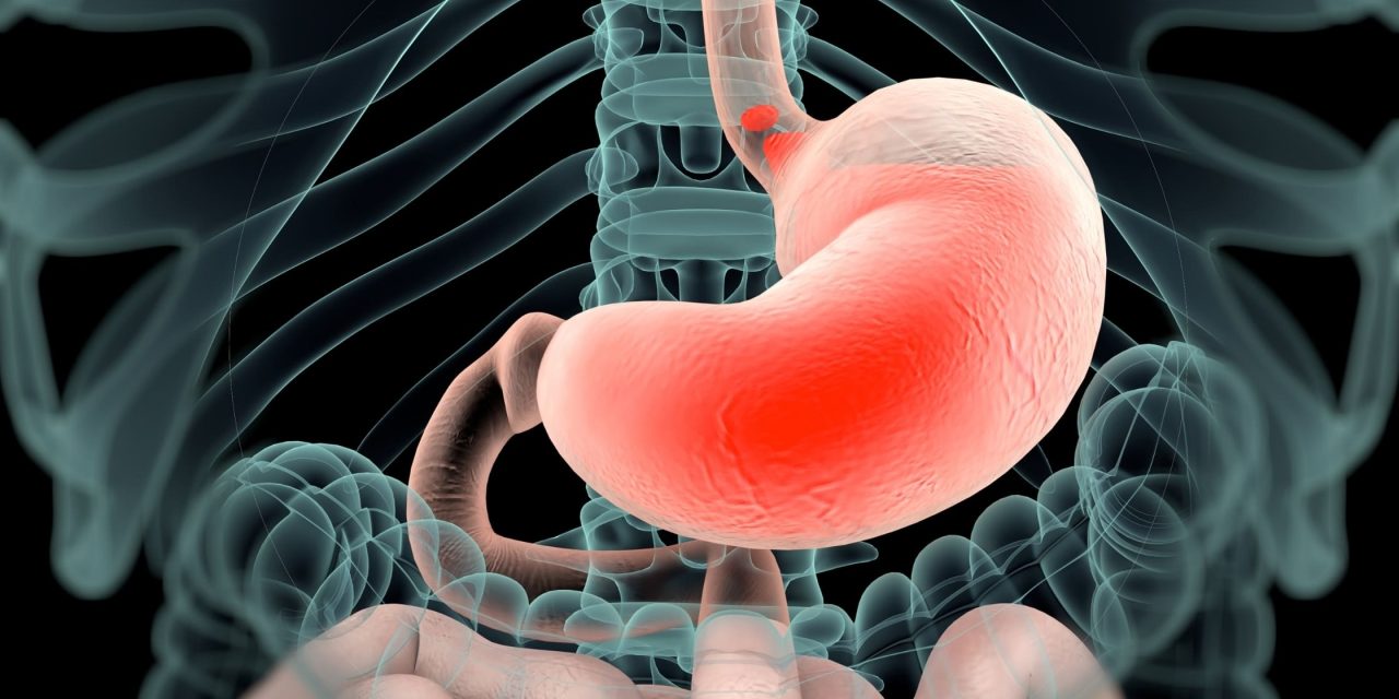 Penyakit Lambung Yang Cukup Berbahaya Yaitu GERD