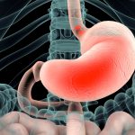 Penyakit Lambung Yang Cukup Berbahaya Yaitu GERD